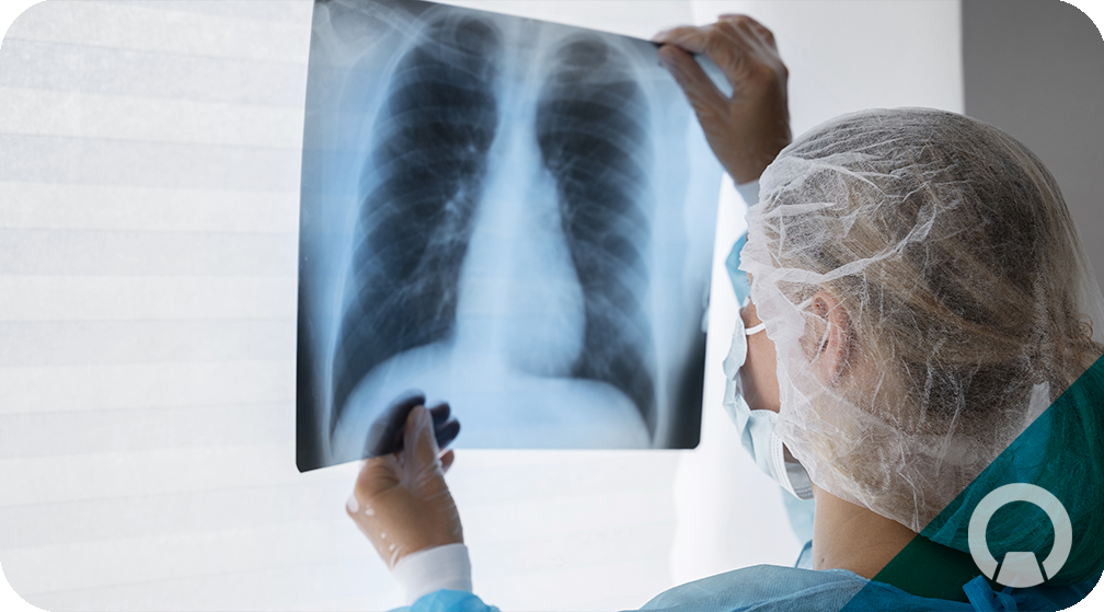 Radiografías en Imagenología HGGB